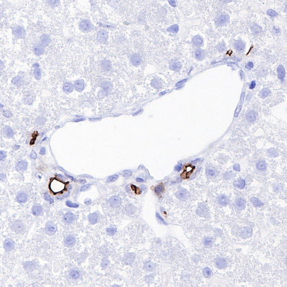 Ezrin Recombinant Rabbit mAb (S-R358)