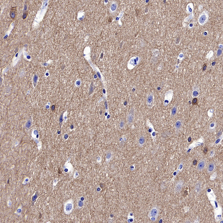 GABRA1 Recombinant Rabbit mAb (S-3254-10)