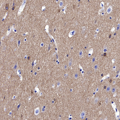GABRA1 Recombinant Rabbit mAb (S-3254-10)
