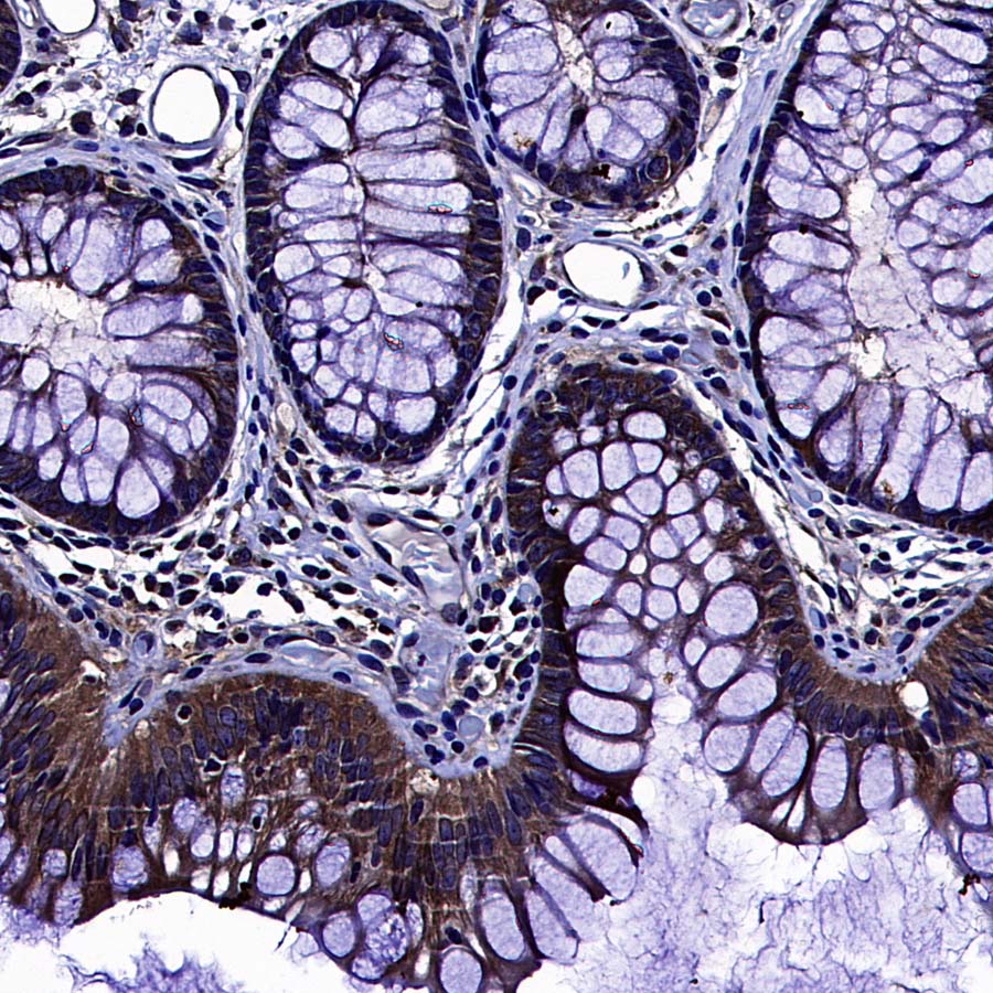 AKT1S1/PRAS40 Recombinant Rabbit mAb (S-4240-49)