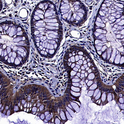 AKT1S1/PRAS40 Recombinant Rabbit mAb (S-4240-49)