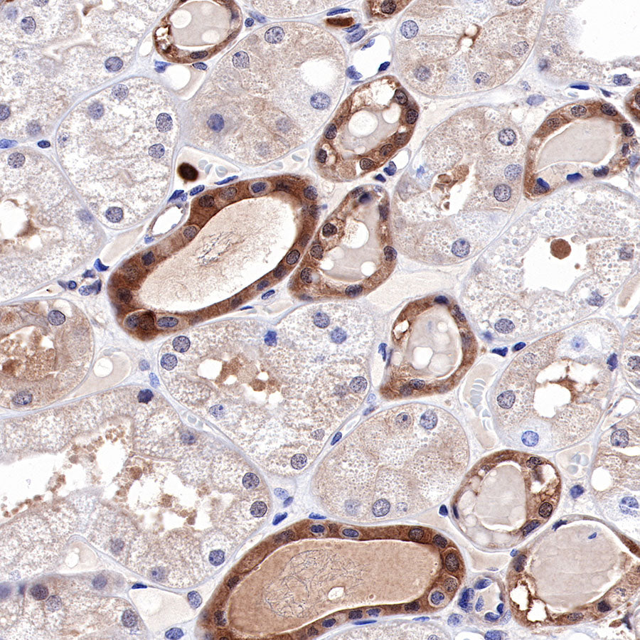 MEK1 Recombinant Rabbit mAb (SDT-308-32)