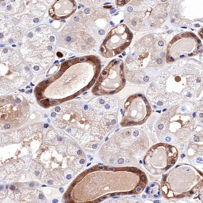 MEK1 Recombinant Rabbit mAb (SDT-308-32)