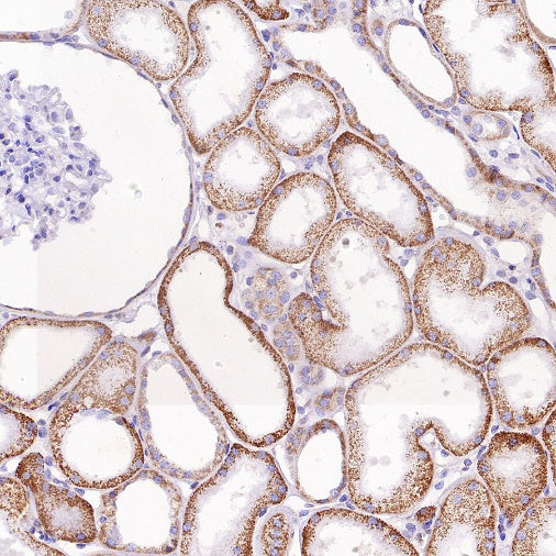 SFXN1/TCC Rabbit Polyclonal Antibody