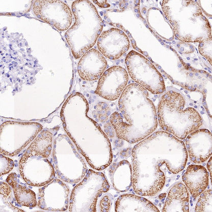 SFXN1/TCC Rabbit Polyclonal Antibody