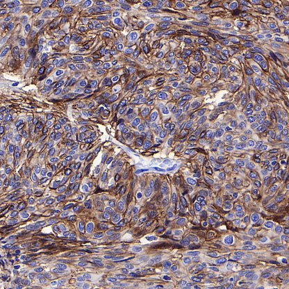 ALCAM Recombinant Rabbit mAb (S-4080-40)