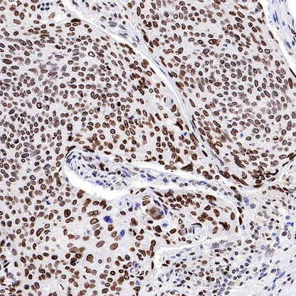 Topoisomerase I/TOP1 Recombinant Rabbit mAb (S-822-60)