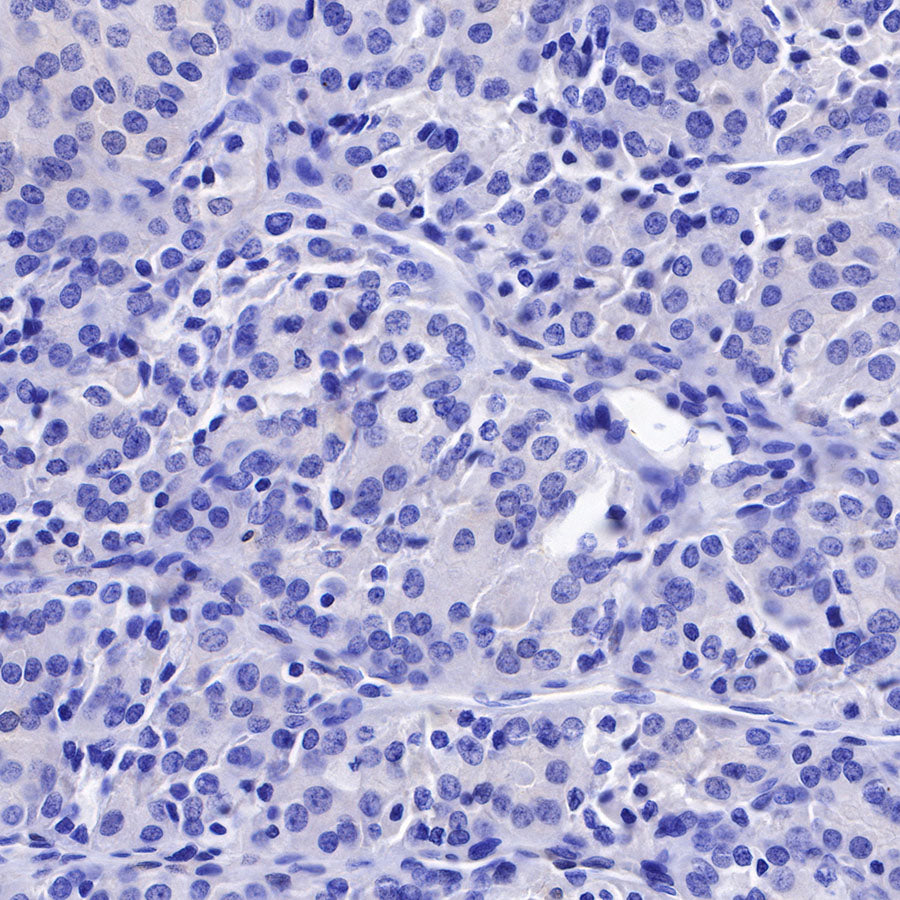 Galectin-3 Recombinant Rabbit mAb (SDT-370-111)