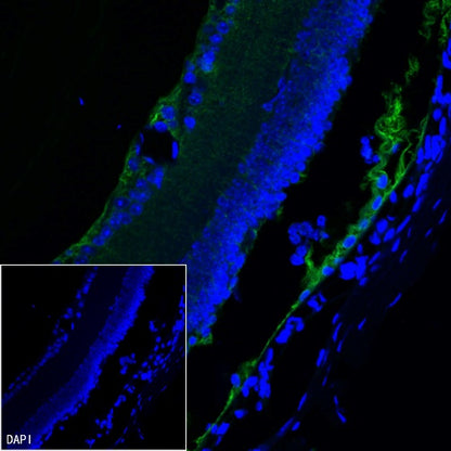 CRALBP Rabbit Polyclonal Antibody