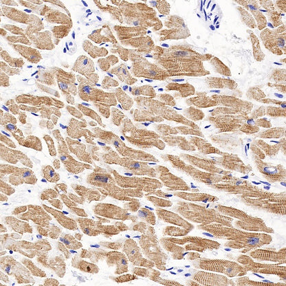 Sarcomeric Alpha Actinin Recombinant Rabbit mAb (S-1652-40)
