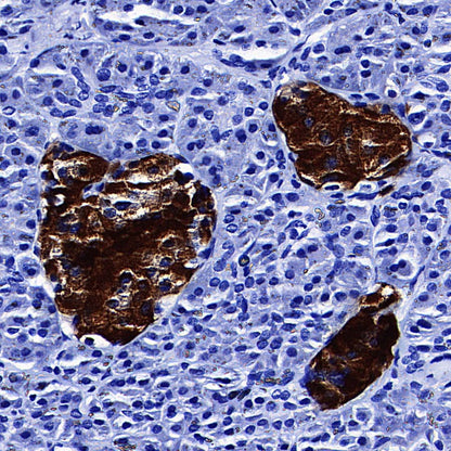 NPTX2 Recombinant Rabbit mAb (S-4048-54)