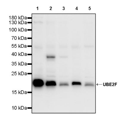UBE2F Recombinant Rabbit mAb (S-2672-26)