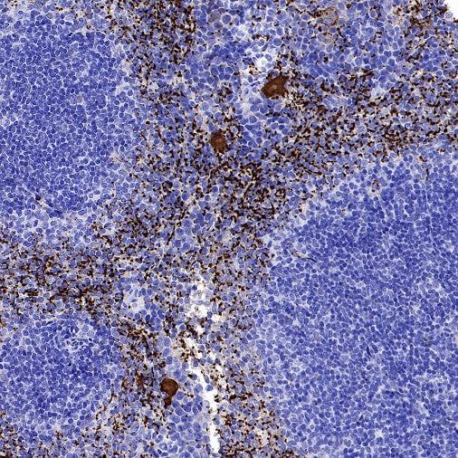 CD61 Recombinant Rabbit mAb (S-2515-6)