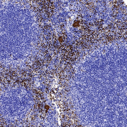 CD61 Recombinant Rabbit mAb (S-2515-6)