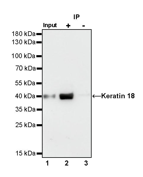 S-RMab® Keratin 18 Recombinant Rabbit mAb (SDT-012-7)