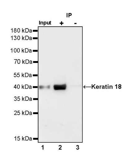 S-RMab® Keratin 18 Recombinant Rabbit mAb (SDT-012-7)