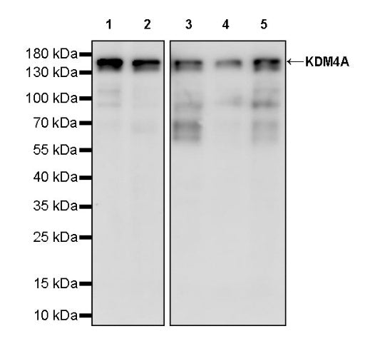 KDM4A Recombinant Rabbit mAb (S-957-138)