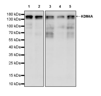 KDM4A Recombinant Rabbit mAb (S-957-138)