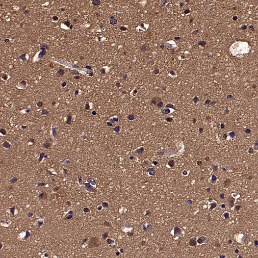 PLCG1 Recombinant Rabbit mAb (S-978-37)