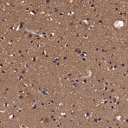 PLCG1 Recombinant Rabbit mAb (S-978-37)