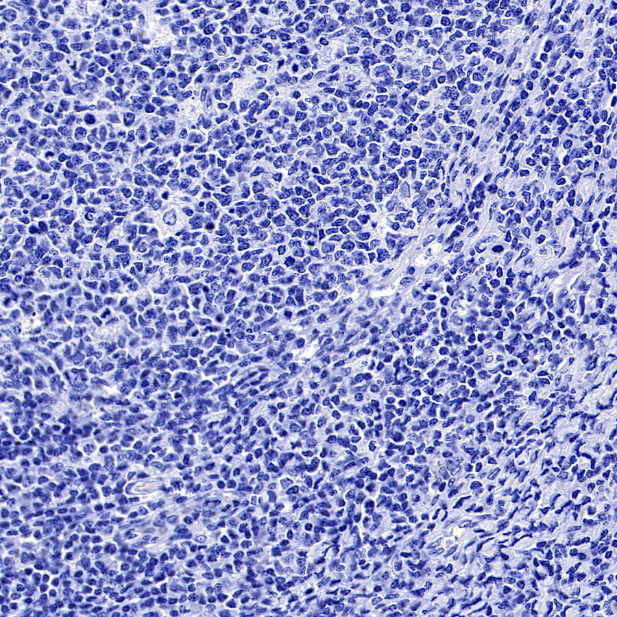 MUC17 Recombinant Rabbit mAb (SDT-3951-56)