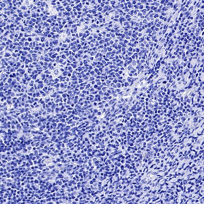 MUC17 Recombinant Rabbit mAb (SDT-3951-56)