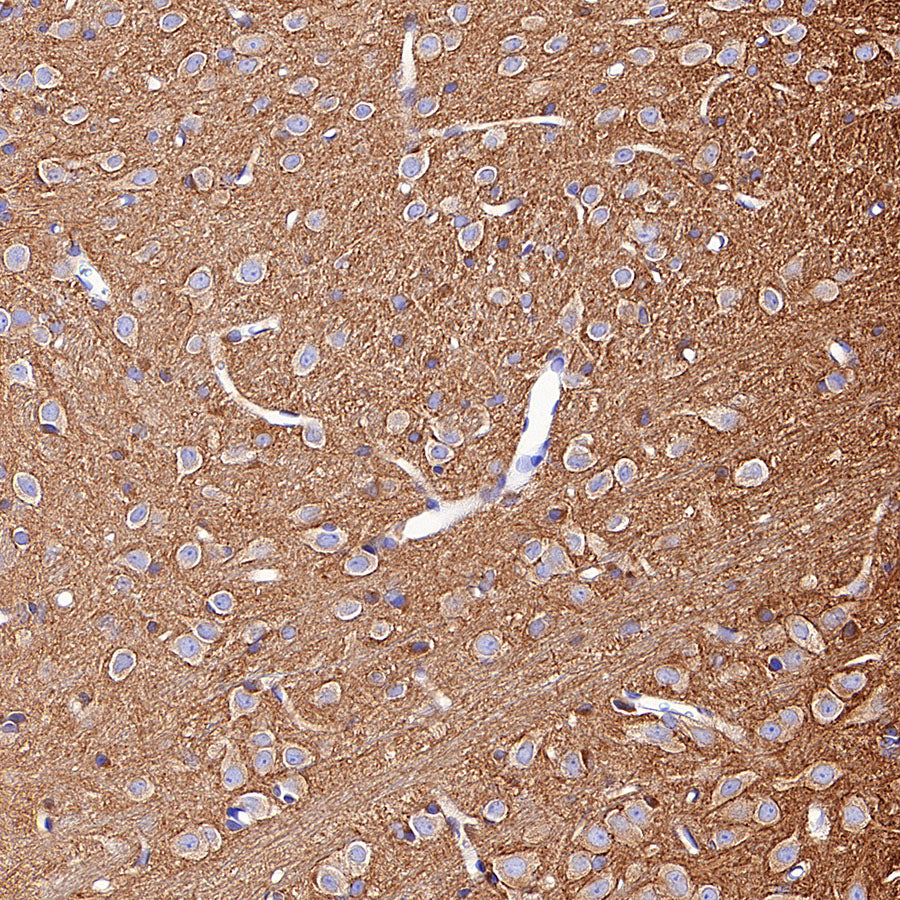 Alpha Tubulin Recombinant Mouse mAb (S-5704)