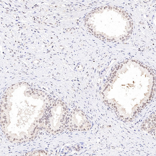 PSME1 Recombinant Rabbit mAb (S-732-14)