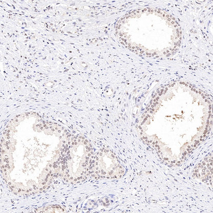 PSME1 Recombinant Rabbit mAb (S-732-14)