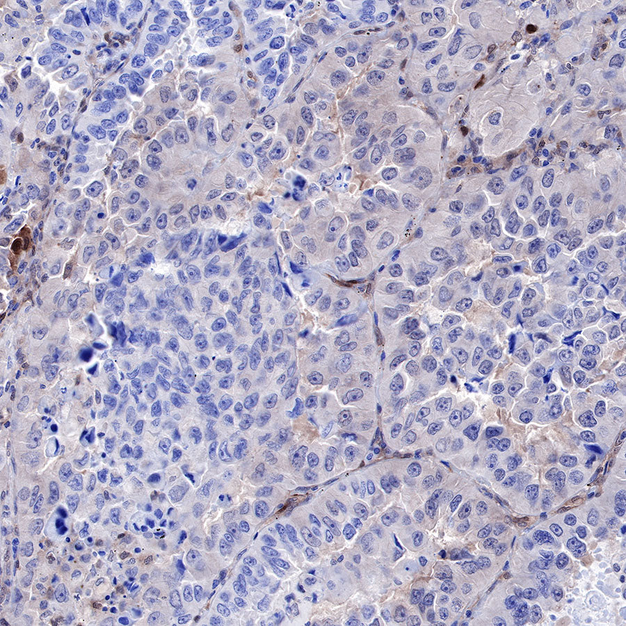 PTEN Recombinant Rabbit mAb (SDT-R074)