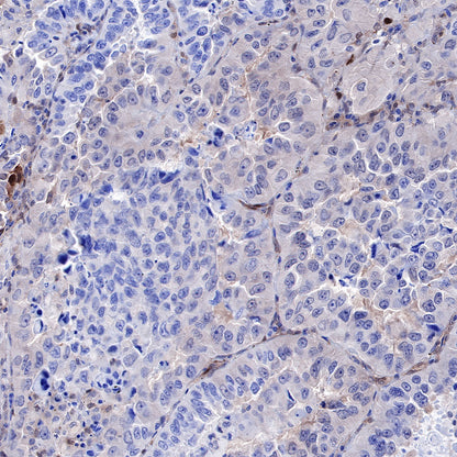 PTEN Recombinant Rabbit mAb (SDT-R074)