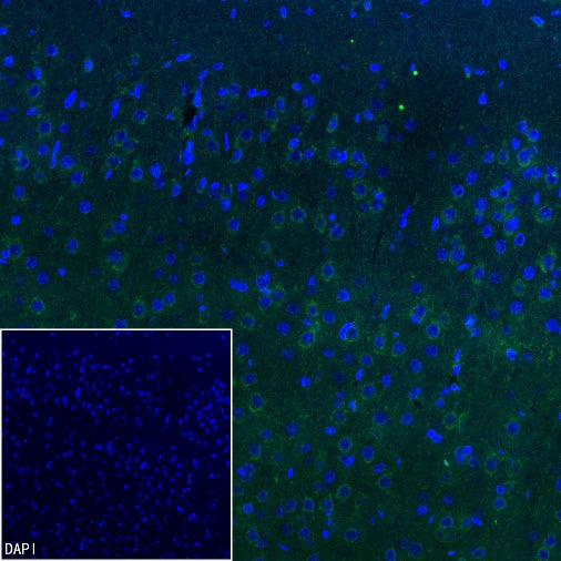 GRIA2 Rabbit Polyclonal Antibody
