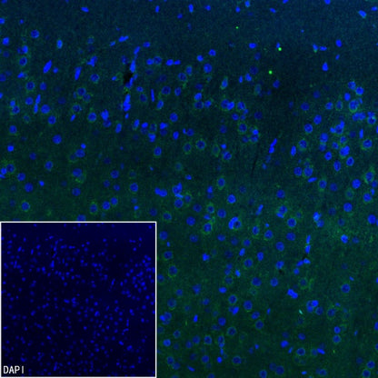 GRIA2 Rabbit Polyclonal Antibody