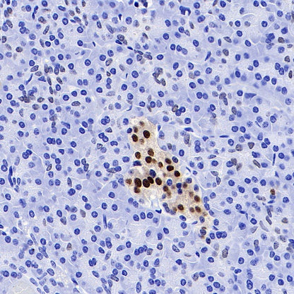 NKX6.1 Recombinant Rabbit mAb (S-260-31)