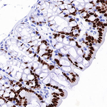 HNF4α Recombinant Rabbit mAb (SDT-373-64)