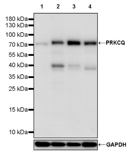 PRKCQ Recombinant Rabbit mAb (S-2511-11)