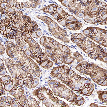ALCAM Recombinant Rabbit mAb (S-4080-40)
