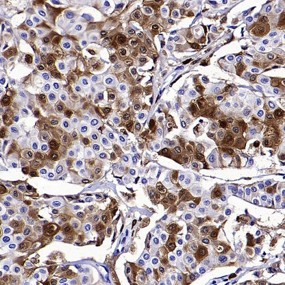 ALOX5 Recombinant Rabbit mAb (S-1980-27)