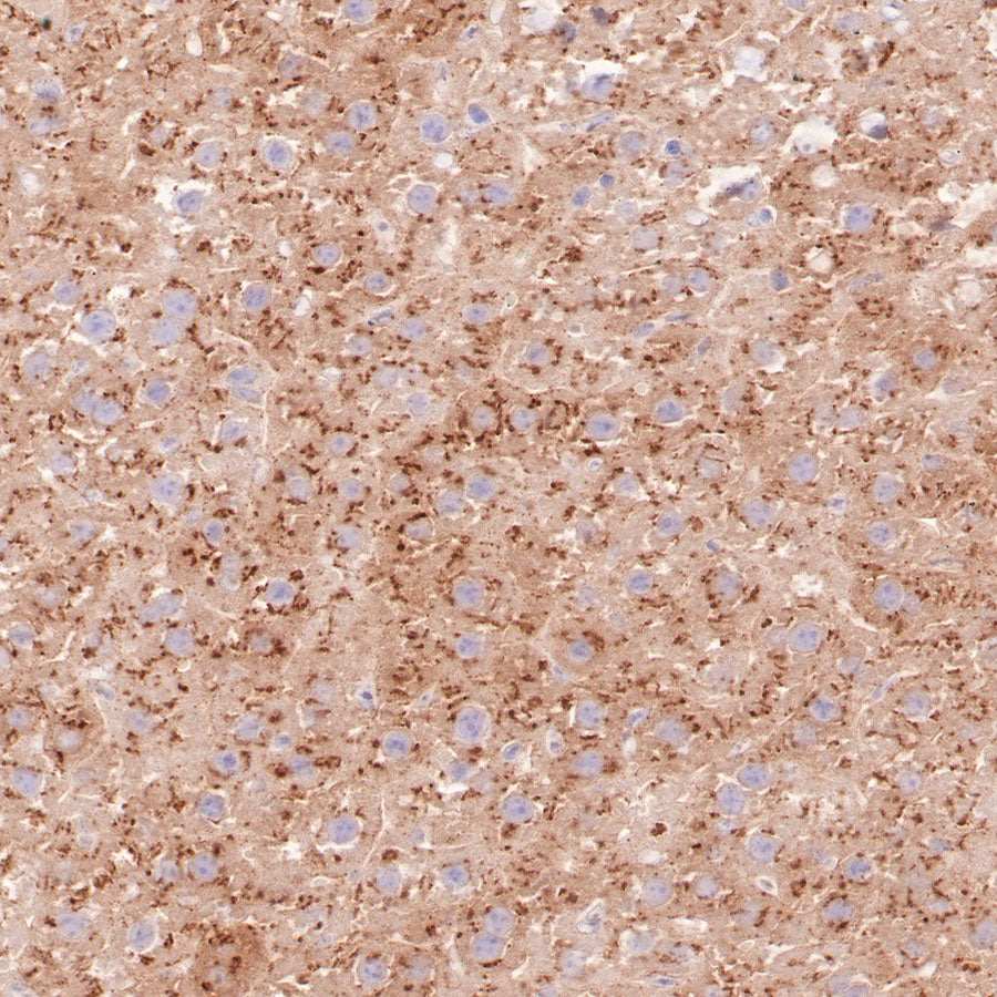 AMACR/p504s Recombinant Rabbit mAb (SDT-401-29)