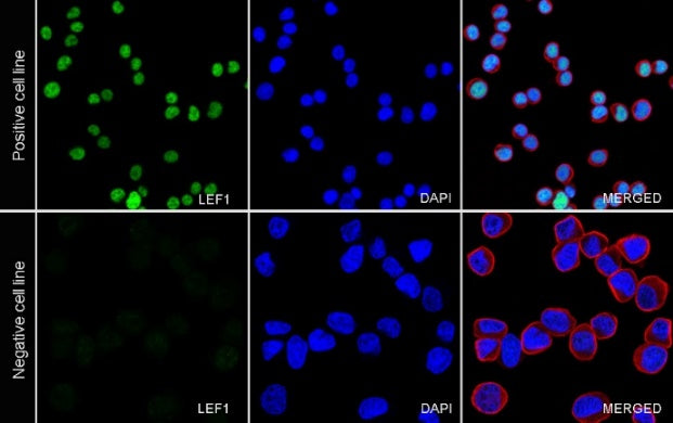 LEF1 Recombinant Rabbit mAb (S-500-34)