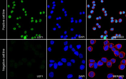LEF1 Recombinant Rabbit mAb (S-500-34)