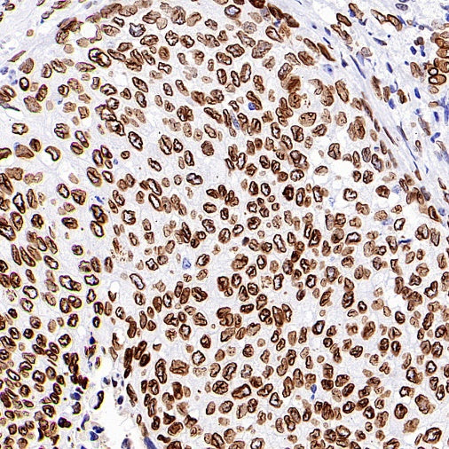 Lamin A/C Recombinant Rabbit mAb (S-950-164)