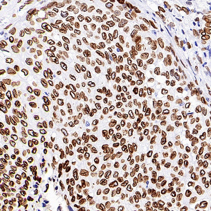 Lamin A/C Recombinant Rabbit mAb (S-950-164)