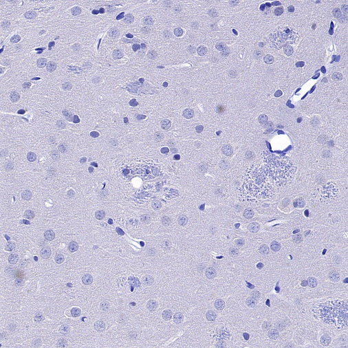 Human Cytoplasmic Marker Recombinant Mouse mAb (SDT-2921)