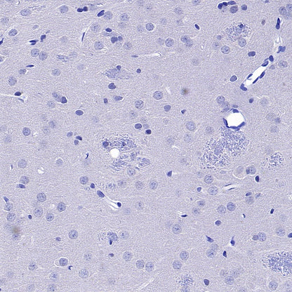 Human Cytoplasmic Marker Recombinant Mouse mAb (SDT-2921)