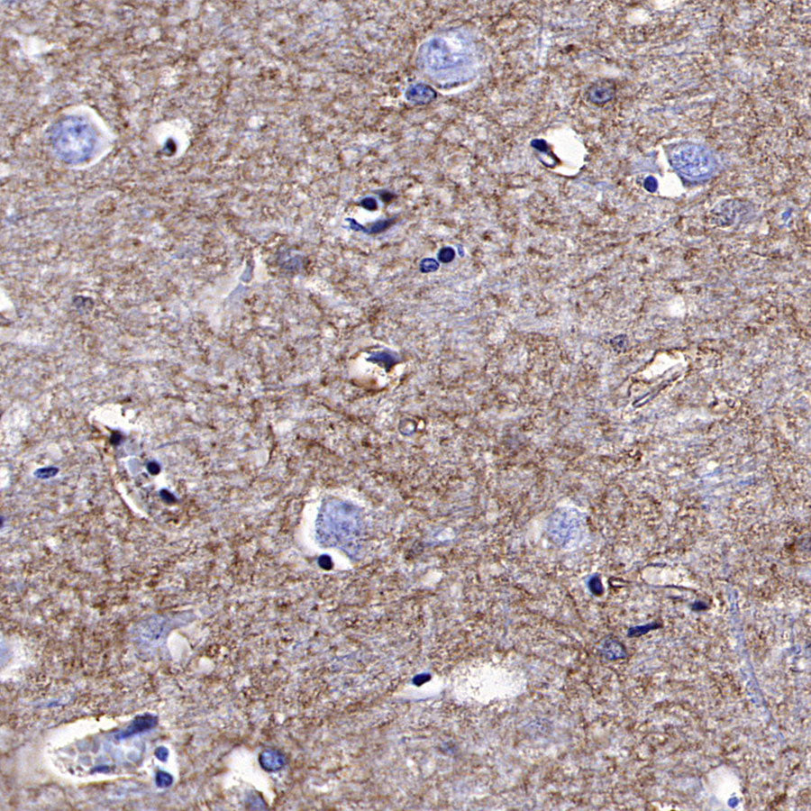 xCT Recombinant Rabbit mAb (S-5531)