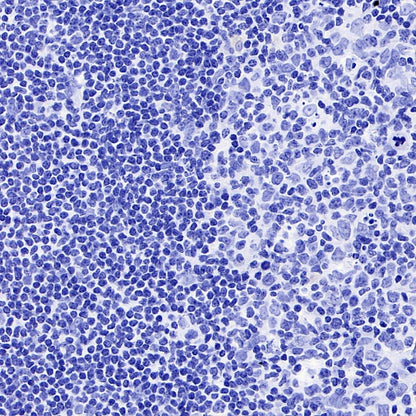 Luteinizing Hormone Beta Recombinant Rabbit mAb (SDT-545-2)