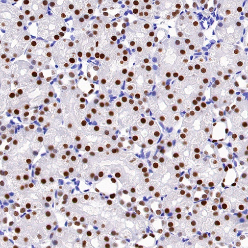 PAX8 Recombinant Rabbit mAb (SDT-R509)