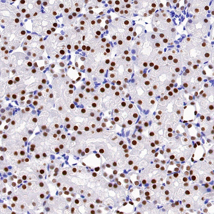 PAX8 Recombinant Rabbit mAb (SDT-R509)