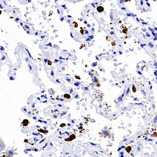 Prosurfactant Protein C Recombinant Rabbit mAb (S-1773-6)